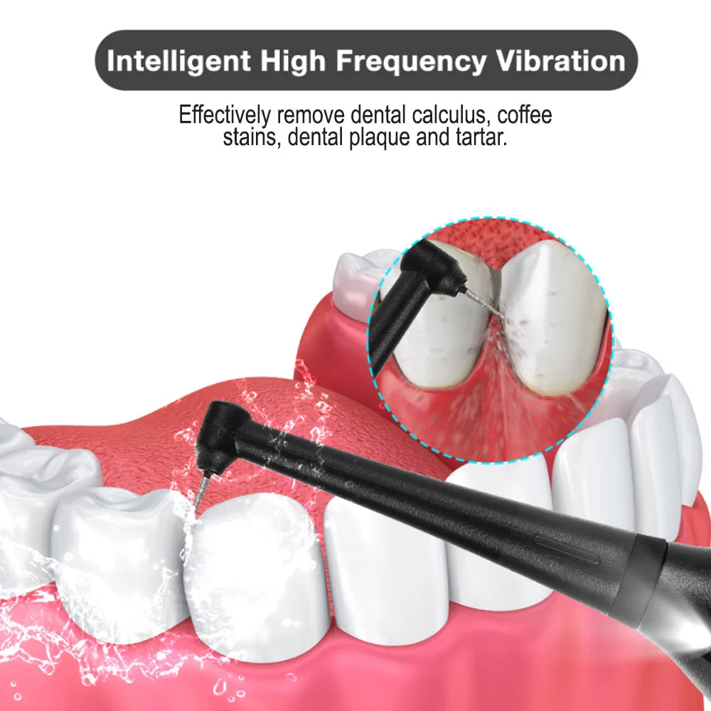 Vibe Geeks USB Rechargeable Electric Dental Calculus Tooth